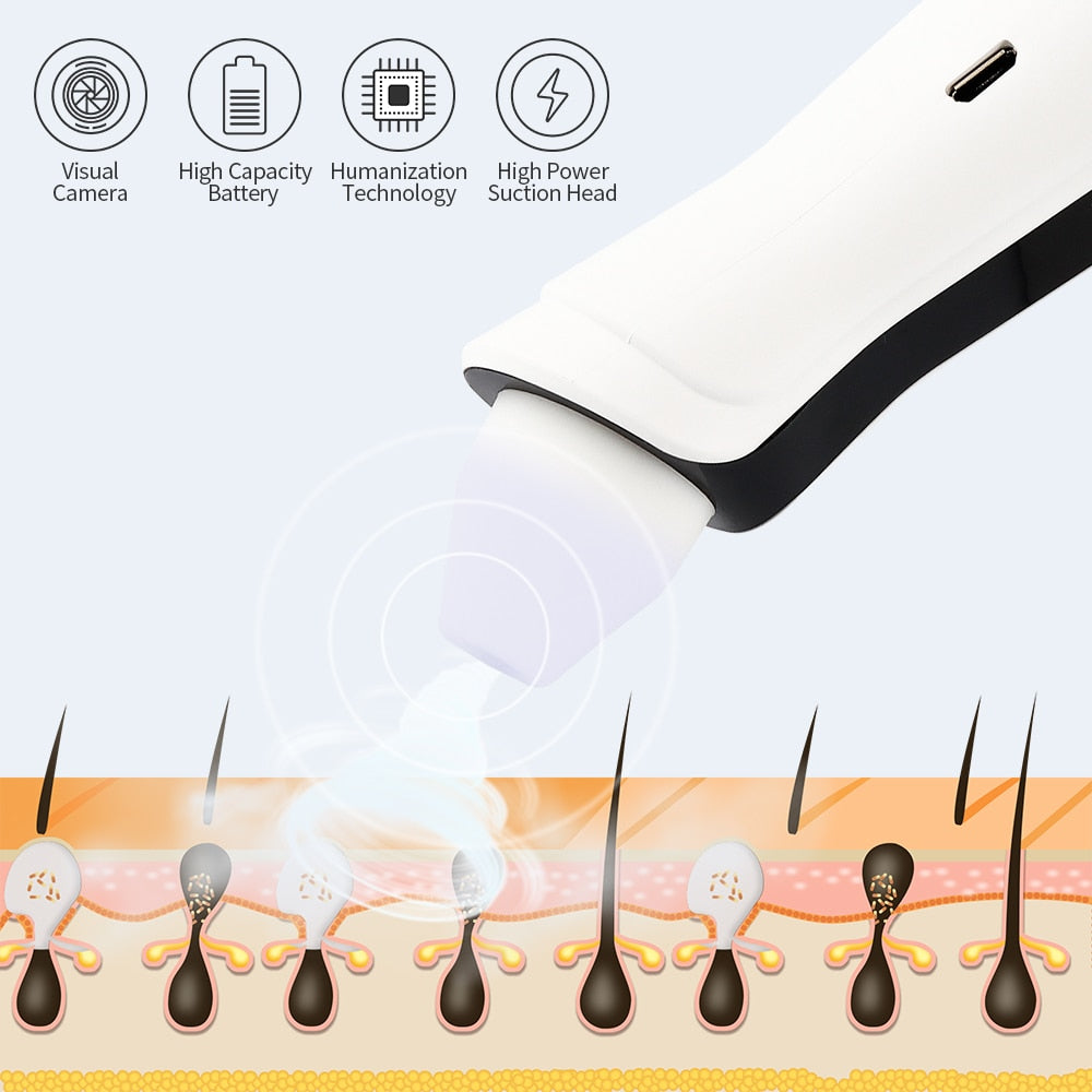 Blackhead Remover 3 Silicon Head Nose Face Deep Pore Cleaner