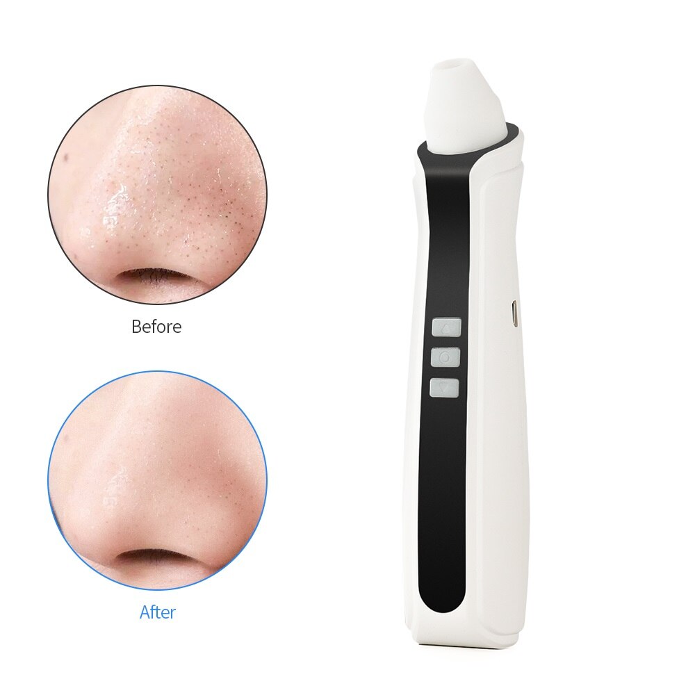 Blackhead Remover 3 Silicon Head Nose Face Deep Pore Cleaner