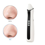 Blackhead Remover 3 Silicon Head Nose Face Deep Pore Cleaner