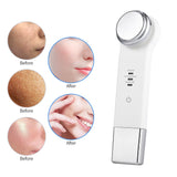 Multifunctional Wrinkle Removal Skin Lift Massager Device