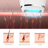 ICE Cold IPL Hair Removal Laser Epilator