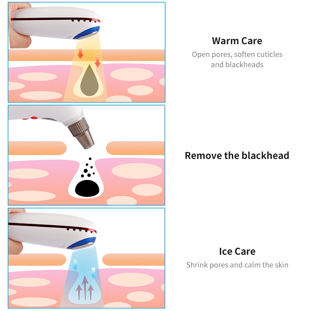 Rechargeable Vacuum Pore Cleaner Blackhead Acne Removal