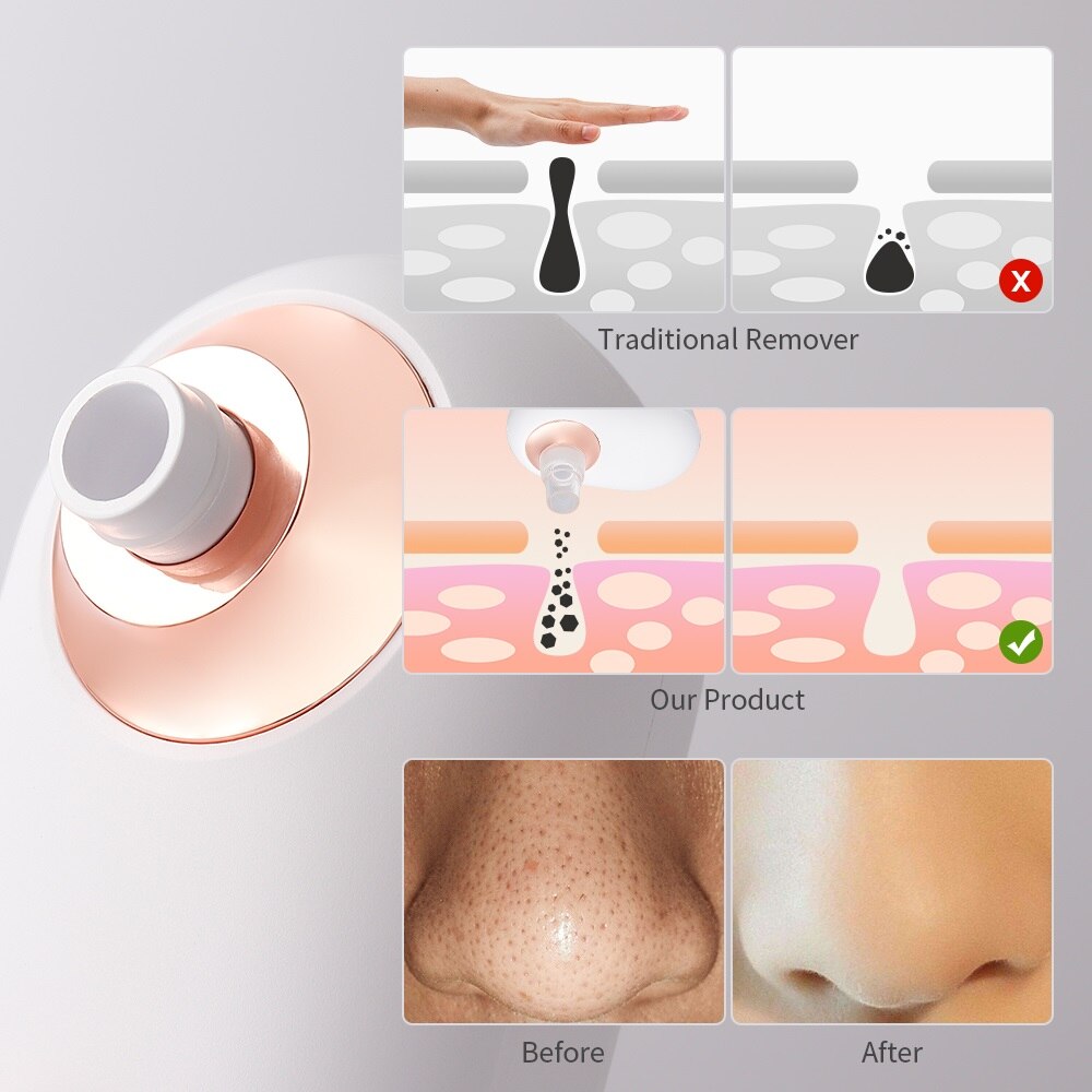 Blackhead Remover Vacuum Acne Pimple Removal USB Charging