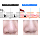 Pore Cleaner Electric Micro Crystalline Blackhead Remover