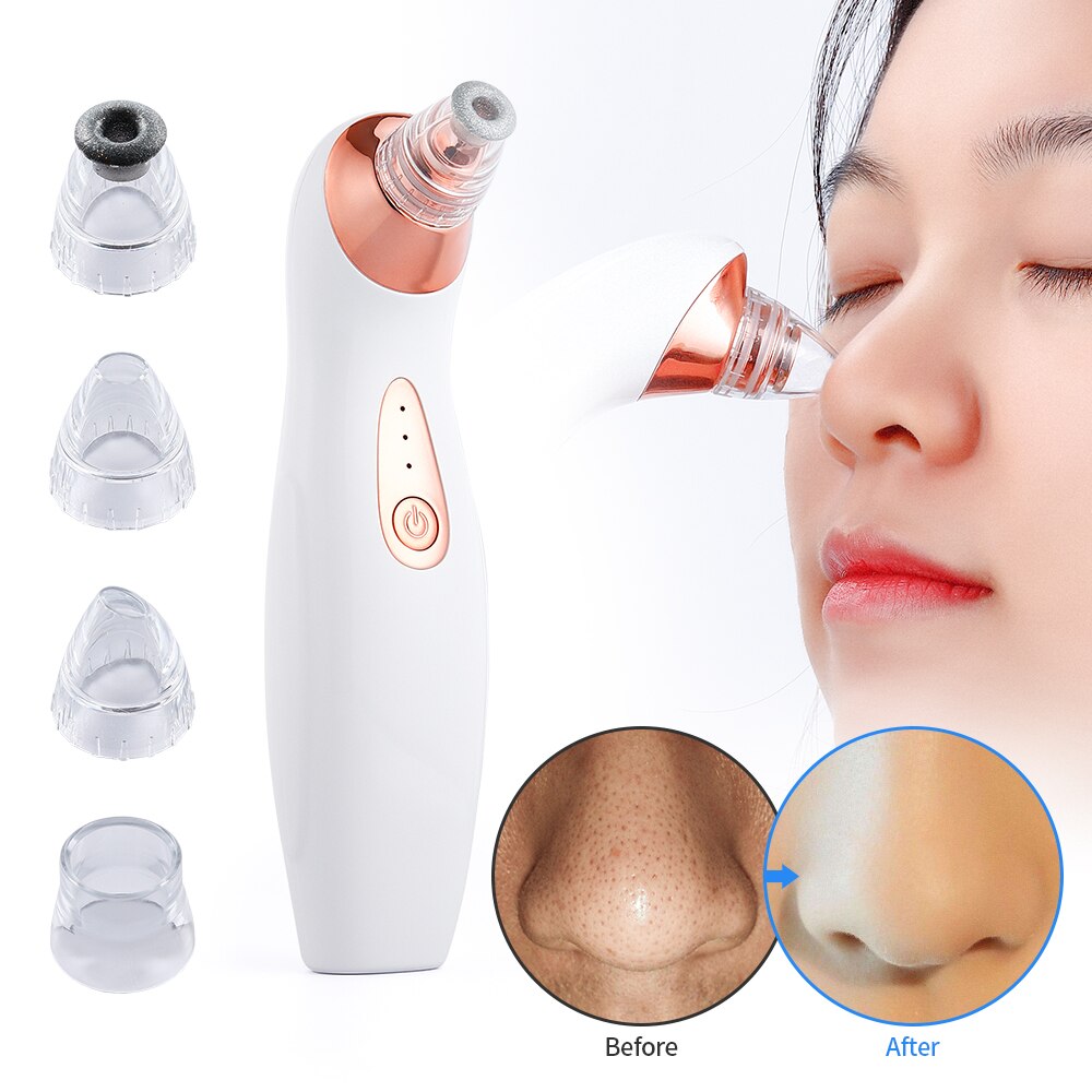 3 levels Pimple Acen Blackhead Remover