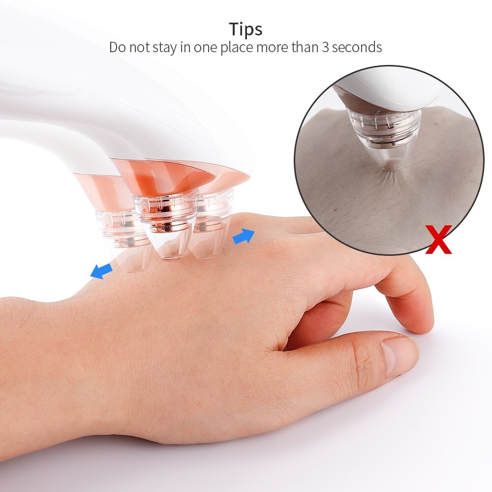 3 levels Pimple Acen Blackhead Remover