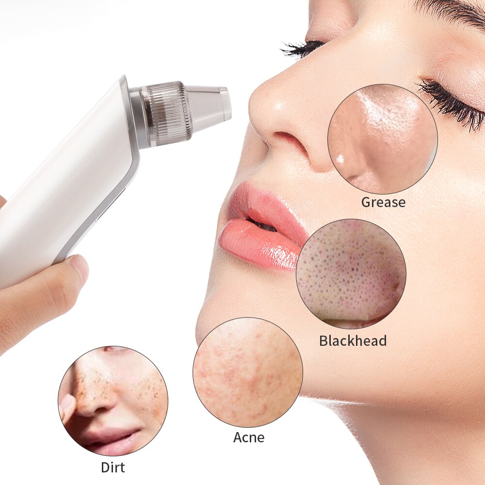 Blackhead Vacuum Suction Pore Pimple Cleaner Remover