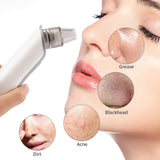 Blackhead Vacuum Suction Pore Pimple Cleaner Remover