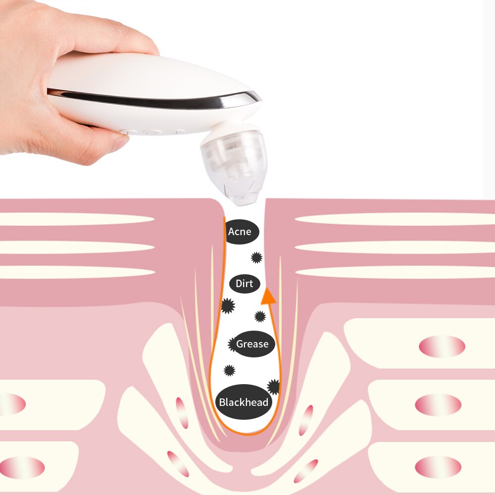 Wireless Charge Electric Skin Care Tools Blackhead Remover