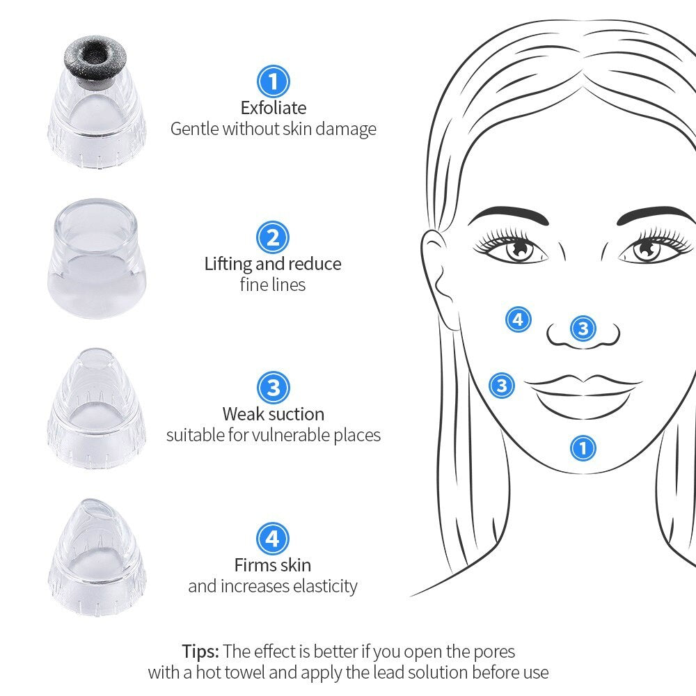 3 levels Pimple Acen Blackhead Remover